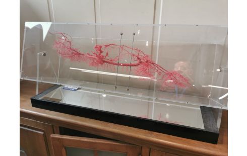 Gunther von Hagens SCULPTURE contemporaine sous plexi système artèrien porcin
