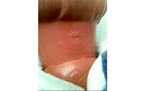 MUÑECA
